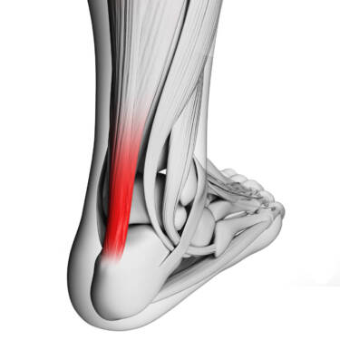 achilles tendon anatomy
