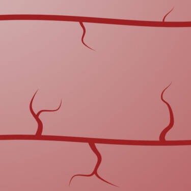 angiogenesis - blood vessel formation